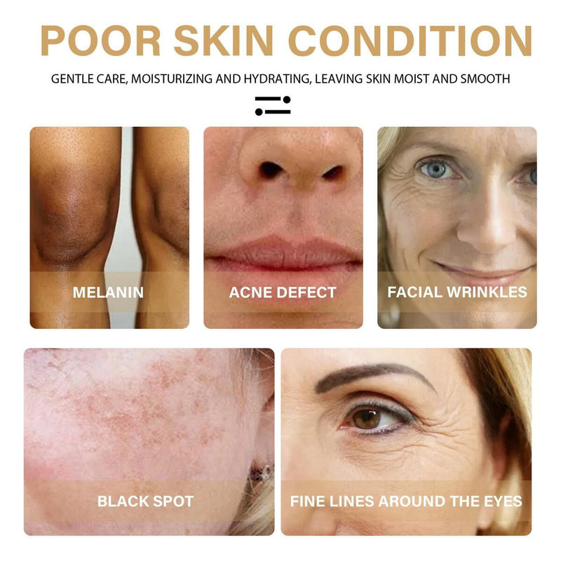 30ML Turmeric Face Serum Turmeric Dark Spot Corrector Serums Corrector Remover~