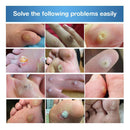 24pcs Feet Warts Remover Pads Foot Callus Corn Stickers Foot Care Plaster