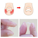 24pcs Nail Correction Tool Ingrown Toenail Paronychia Fixer Nail Paster Kit