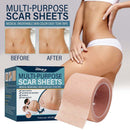 Skin Tone Concealer Tattoo Stickers Cover Up Burn Scars Birthmark Patches