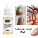 Nail Fungus Treatment Nail Oil Pen Anti Fungal Nail Remove Q4Y8 L0J1 C8K4