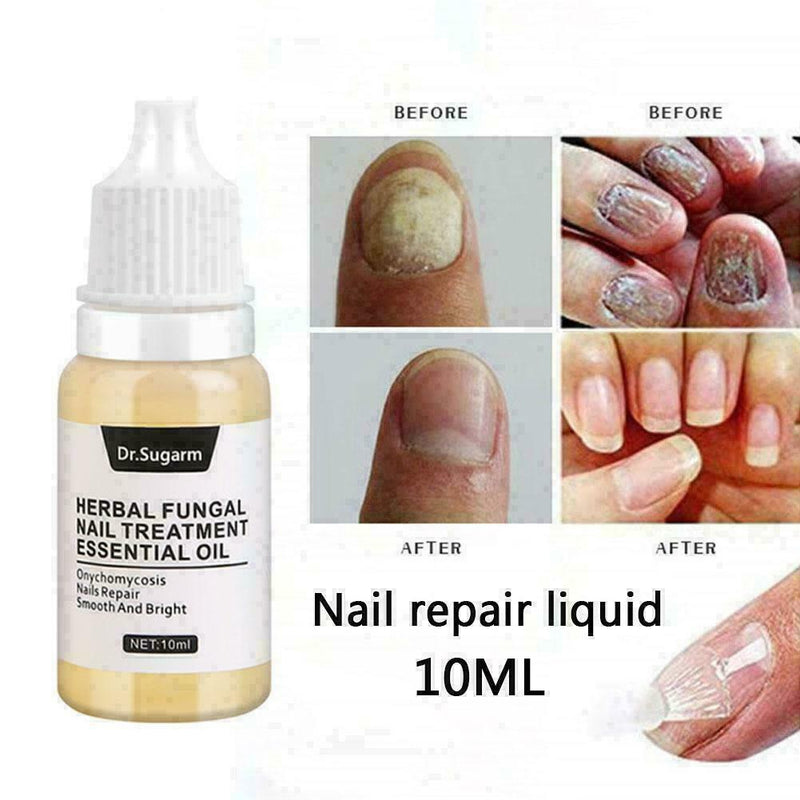 Nail Fungus Treatment Nail Oil Pen Anti Fungal Nail Remove Q4Y8 L0J1 C8K4