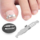 Ingrown Toenail Correction Tools Toenail Treatment Professional Portable Supply