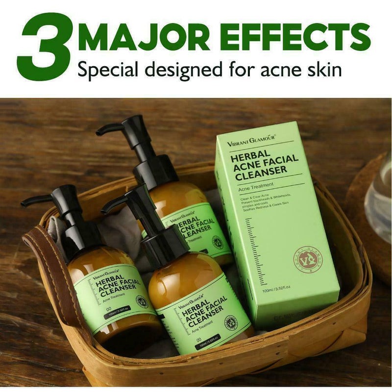 Herbal Acne Facial Cleanser Shrink Pore Foam Oil Control Brightening Skin V8J8