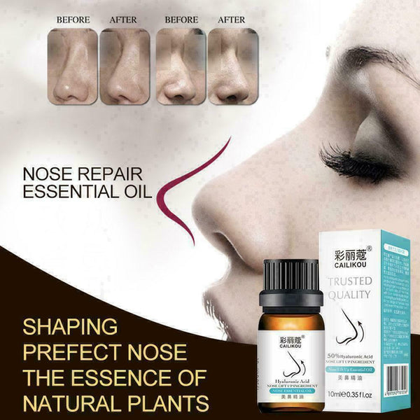 Nose Up Heighten Rhinoplasty Essential Oil 10ml Nasal R6J3 Rmodeling K2G1 K9S0