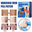 Varicose Vein Patch Leg Relief Blood Promote Patch Pain Smooth Vasculitis Q1B5