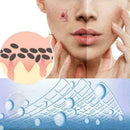 30g Centella Asiatica Exfoliating Gel Nourishing Moisturizing Cleanser O2C6 W3J6