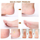Corn Plane Blades Set Pro Callus Rasp Tool Salon Pedicure Foot Sharp 10 Pieces.