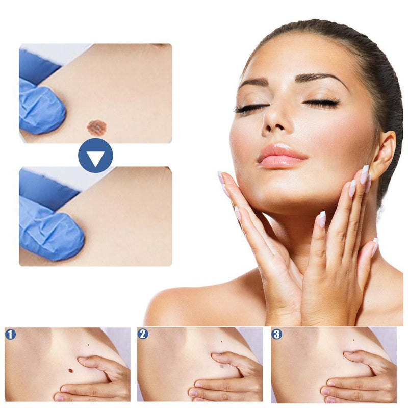 Skin Tag Remover Warts Remover Patch Anti Verruca Remedy Acne Spot Treatment
