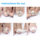 Nail Recover Pedicure Tools Correction Paronychia Ingrown Toenail Straightener