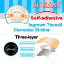 Paronychia Inlay Patch Painless Ingrown Toenail Correction Pedicure Nail Patch