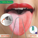 Breath Stainless Steel Dental Cleaning Oral Hygiene Tongue Scraper Cleaner