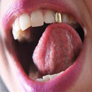 #A 3pcs Single Tooth Grillz Food Grade Tooth Clips Veneers Teeth Braces Oral Bea