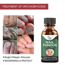 Nails Toes Care Painless Nail Fungus Treatment Nail Repair Liquid Fungus Serum