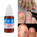 Anti Fungal Treatment Fungus Effective Finger Toe Nail Repair Liquid Solu F7X0