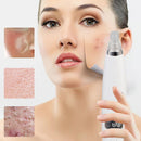 Blackhead Vacuum Pore Machine Deep Face Nose Cleaner Portable Beauty Care Tool