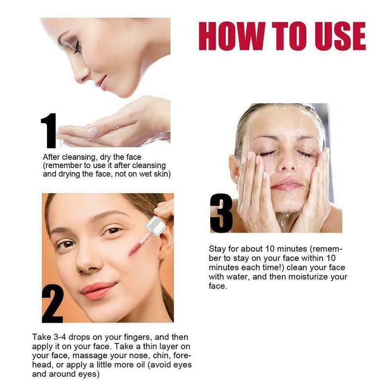 Fruit Salicylic Acid Essence, Anti-Acne Exfoliating Serum, Shrink Pores K8R7