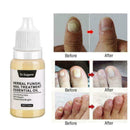 Nail Fungus Treatment Nail Oil Pen Anti Fungal Nail Remove Q4Y8 L0J1 C8K4