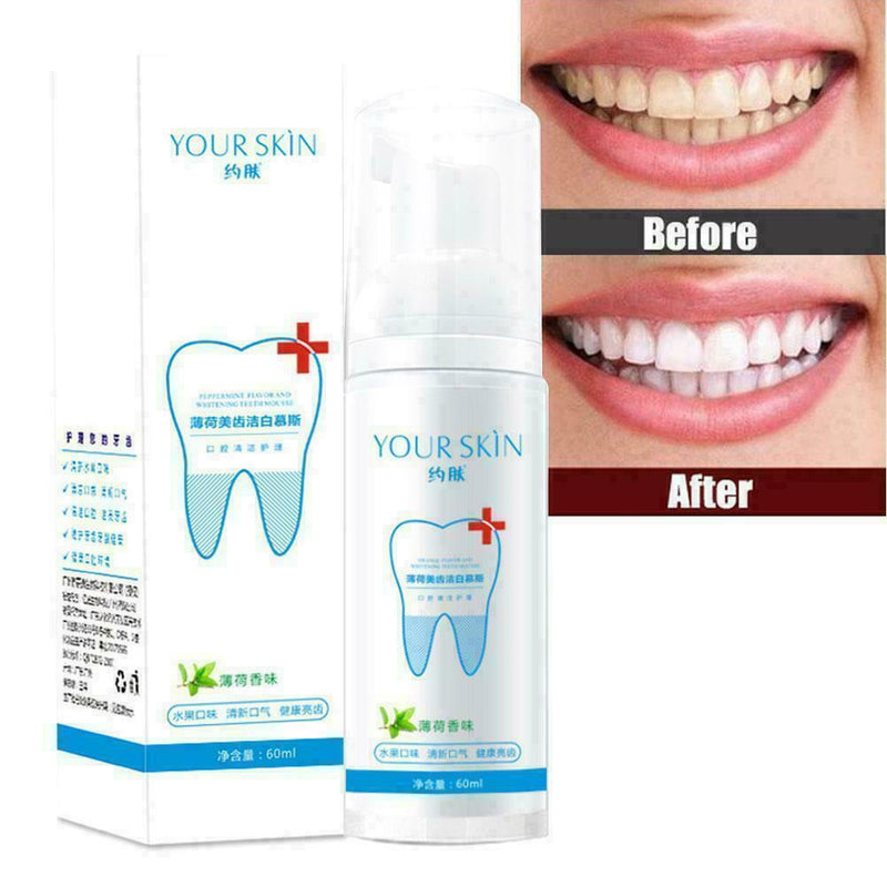 Teeth-Cleaning Whitening Mousse Toothpaste Removes Plaque W4R7 Stains O5D9