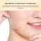 #A Collagen Thread Absorbable Face Lifting Product Tightening Skin Care Ideal