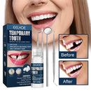 Tooth Filling Repair Beads for Missing Broken Teeth Strong Abrasion Resistance