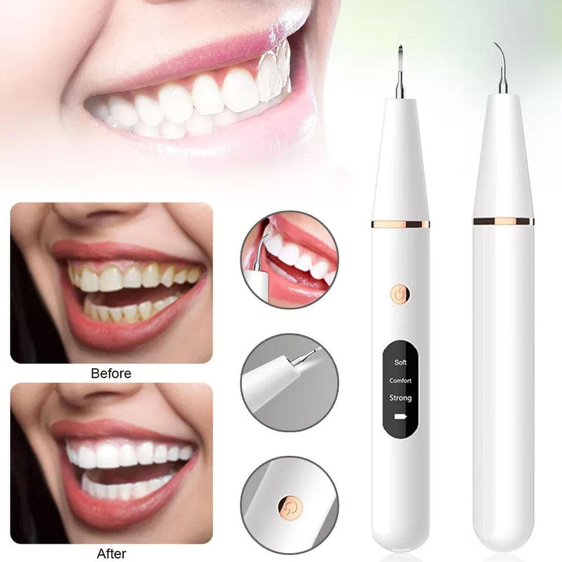 Electric Teeth Cleaning Professional Dental Calculus Plaque Remover Tools Kit~