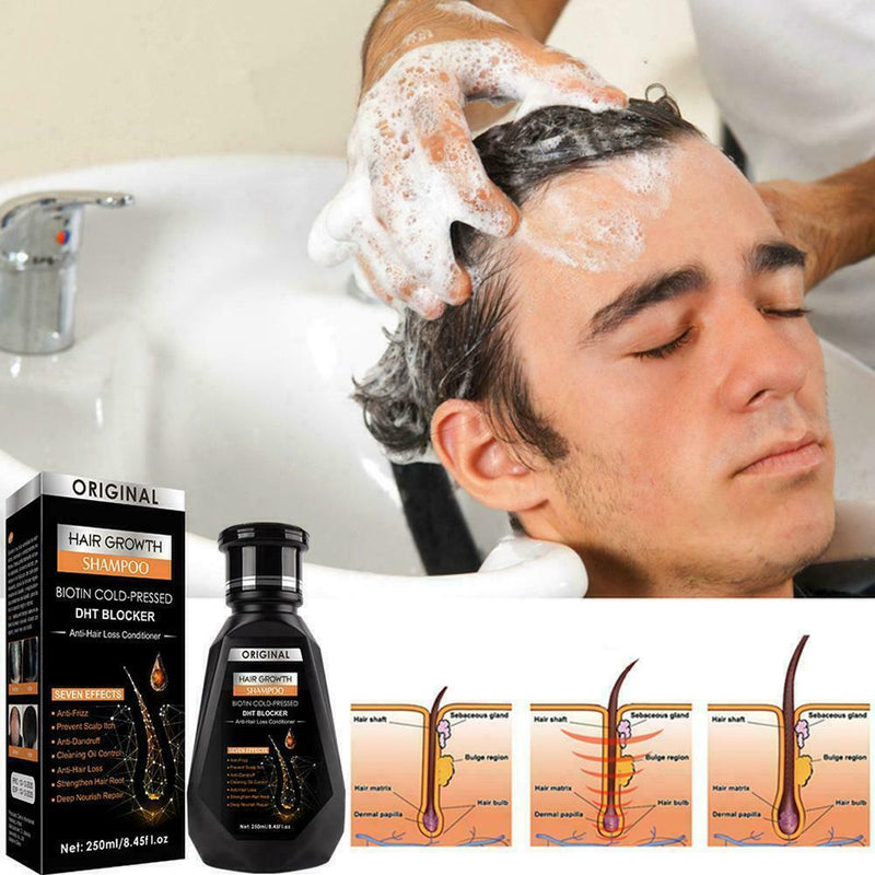 250ml Polygonum Shampoo Ginger Bar Moisturizing Refreshing Hair Control Oil D4G0