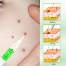 Portable Skin Tag Remover Pen Wart Remover Acne Facial Skin Care Repair Tool