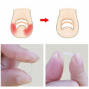 Ingrown Toenail Corrector Strips Brace 10pcs/bottle Straightener Clip Curved#