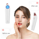 Facial Pore Vacuum Suction Blackhead Remover Face Acne Cleansing Cleaner
