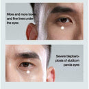 Mens Moisturizing Firming Anti Eye Creams Bags Serum Remove Dark Circle M6O7