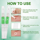 Portable Skin Tag Remover Pen Wart Remover Acne Facial Skin Care Repair Tool