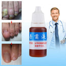 Anti Fungal Treatment Fungus Effective Finger Toe Nail Repair Liquid Solu F7X0
