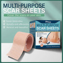 Flaw Hide Tape Birthmark Scar Acne Tattoo Cover Up Concealing Hide Stickers`