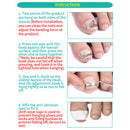Ingrown Toenail Correction Tools Professional Portable Supplies Nail Correction