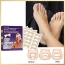 50pcs Stickers Ingrown Toenail Correction Stickers Nail Corrector Patches