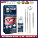 Tooth Filling Repair Beads for Missing Broken Teeth Strong Abrasion Resista