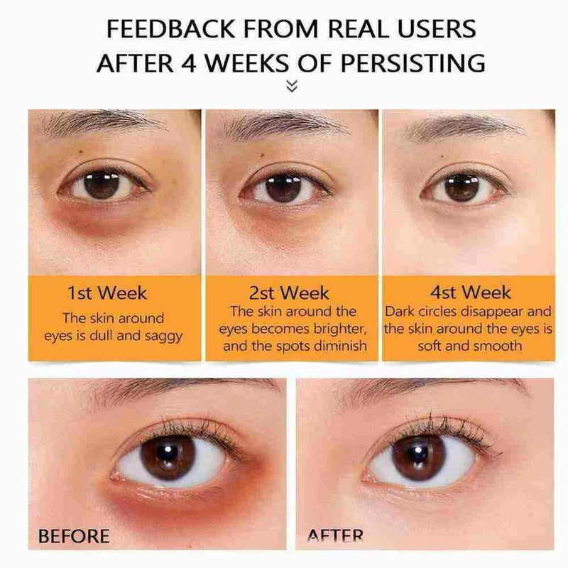 Eye Essence Stock Solution Polysaccharide Uric Acid Fine Lines Corners C3S2
