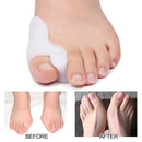 Hallux Valgus Toes Outer Appliance Foot Care Tools Corrector Toes Separator