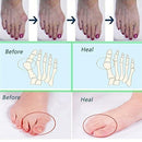 Relief Pain Silicone Toe Separator Foot Care Tools Orthotics Bunion Corrector
