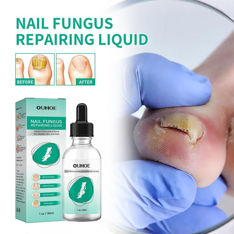30ml Toenail Fungus Oil Nail Care Repair Liquid for Anti Fungal Whitening