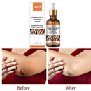 Serum Whitening Removing Dark Knuckles Serum Hand knuckle Eraser Serum Elbow`