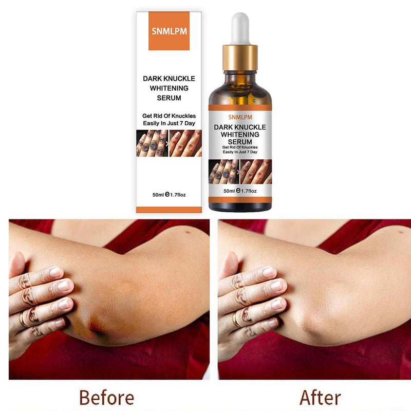 Serum Whitening Removing Dark Knuckles Serum Hand knuckle Eraser Serum Elbow`