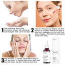 Exfoliating Pores Repair Fruit Acid Shrink Pores Skin Care Salicylic Acid