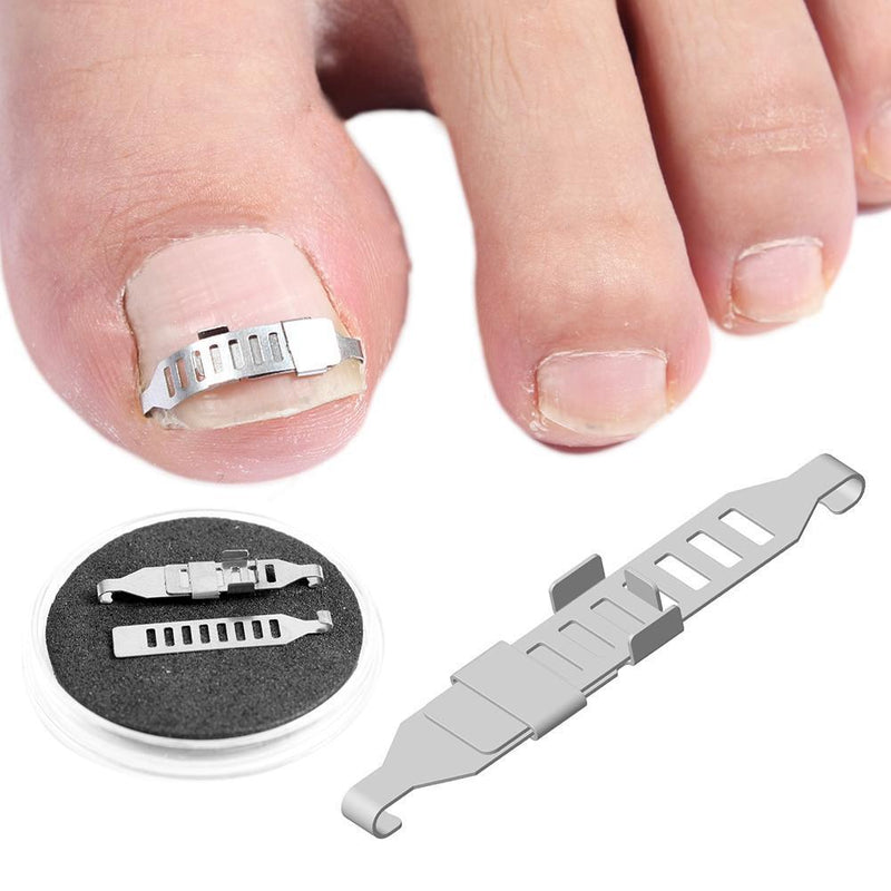 Ingrown Toenail Correction Tools Pedicure Recover Embed Toenail Treatment