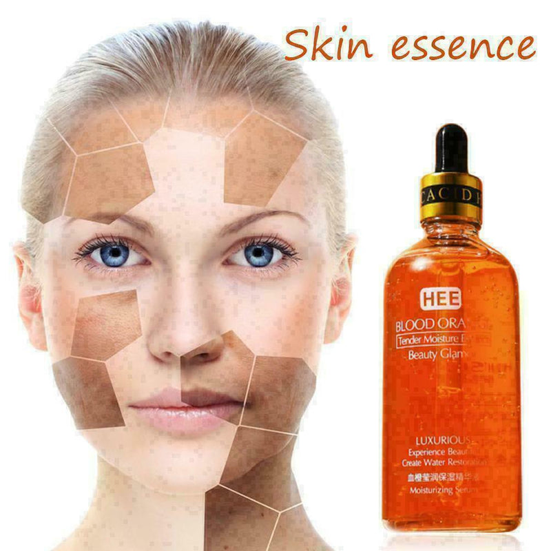 Moisturizing Essence Repairs Replenishes Skin Moisture H3P2 Skin G2H9 N7B3 O7I0