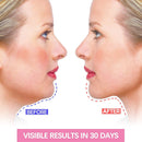 V Shaped Facial Massage Patches Reduce Double Chin Cheek Lift Up Facial Device