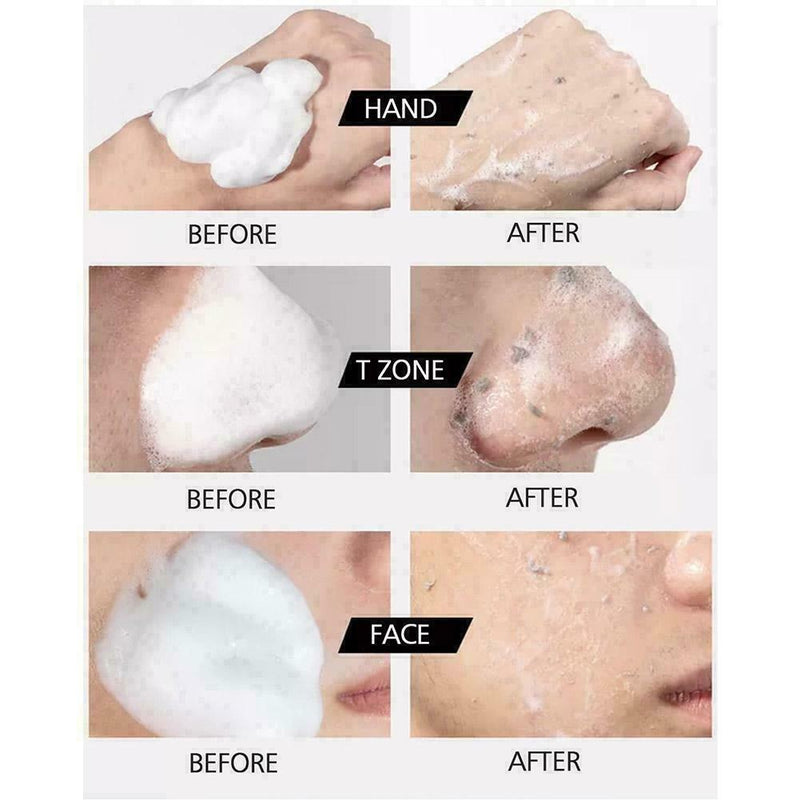 60ml Exfolarting Exfoliating Moisturizer Skin Oil Control Care Shrink Skin L7W4