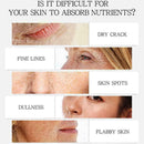 30ml Skin Whitening Lightening Brightening Serum Dark I2R7 Spot K8Y4 C6C5