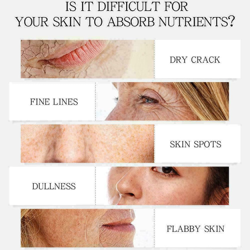 30ml Skin Whitening Lightening Brightening Serum Dark I2R7 Spot K8Y4 C6C5